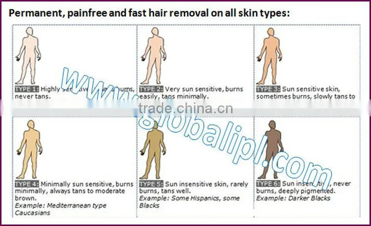 Medical best epilator machine for wholesales