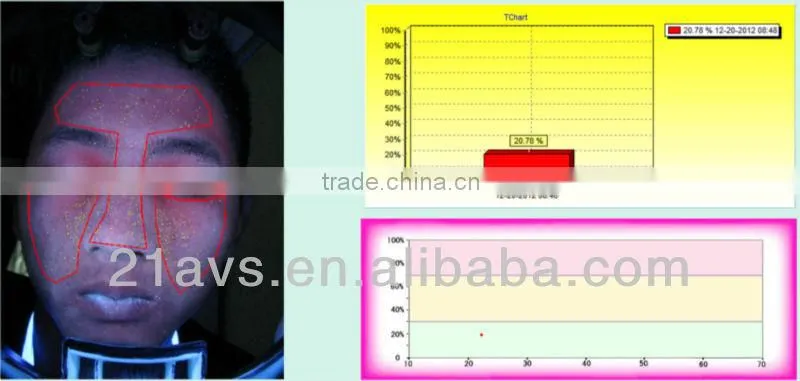 Guangzhou facial skin analysis machine