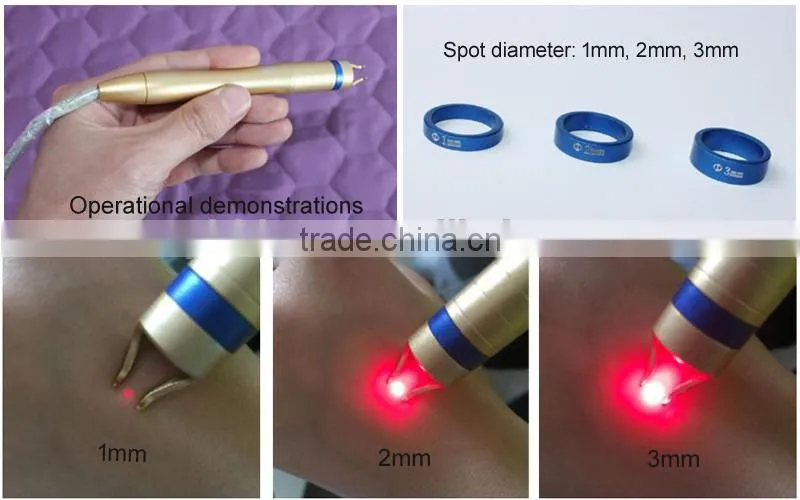Spiritlaser fda approved diode laser equipment vascular remover 980nm Diode Laser Vascular Removal Laser Treatment