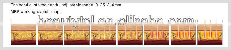 LINGMEI manufacturer salon use rf cooling thermgic face lifting machine/fractional rf face lifting equipment