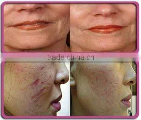 Multi-functional derma roller dermarollerr with beauty package