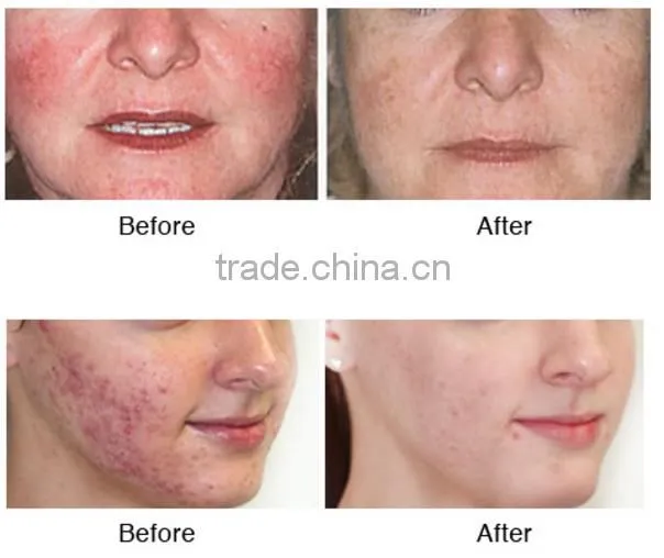 High-frequency 8in1 galvanic facial spa equipment multifunction beauty machine