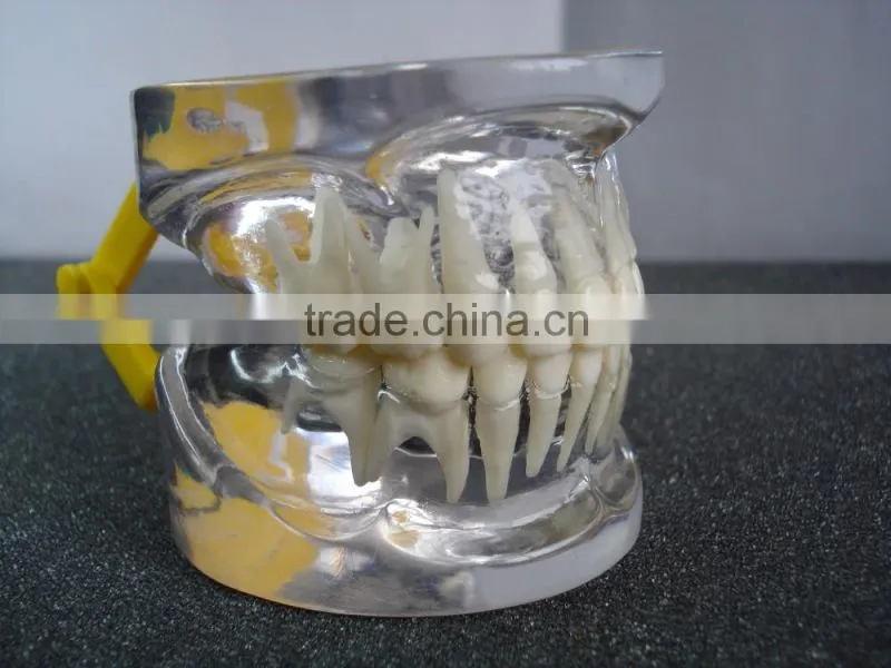Transparant deciduous Teeth Model Teaching And Hospital Demonstration