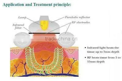 cellulite reduction spa slimming machine