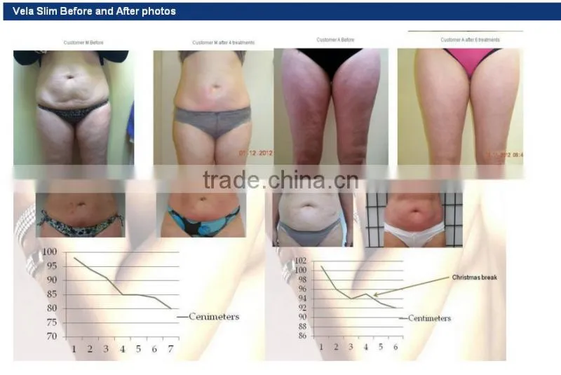 Latest Products in Market VelaSlim fda approved fat loss slimming machine