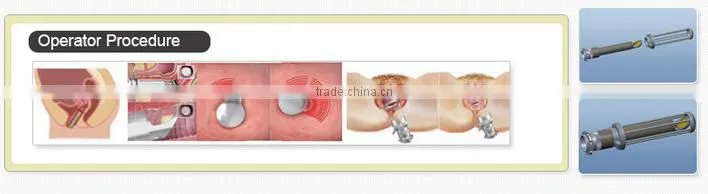 Factory hot sale USA vagina tightening laser/vagina fractional laser