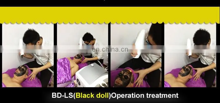 Hot selling! e light laser hair removal cost/opt system cold ipl laser machine price