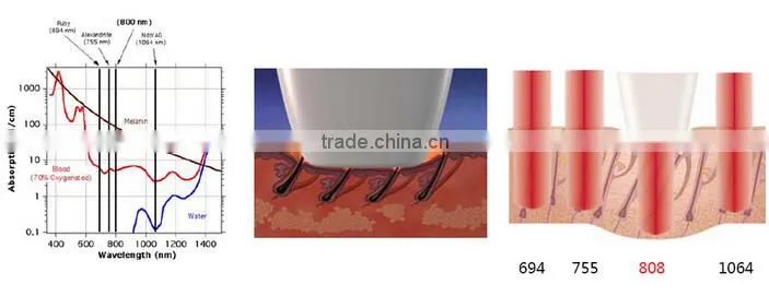professional permanent diode laser hair remover 808/808nm diode laser