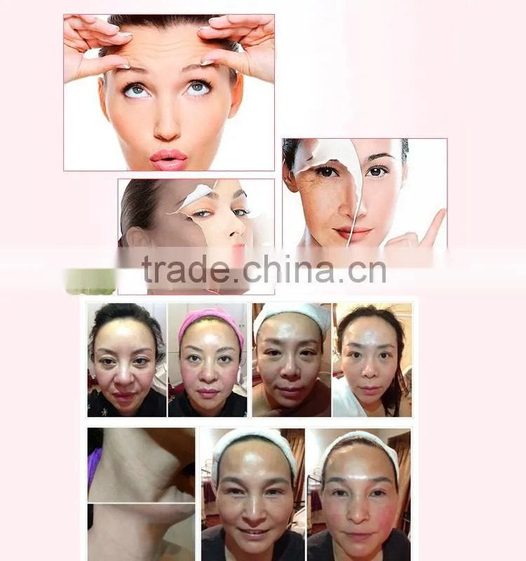 Instant Face Lift Mini Face Massage thread lift face tornado