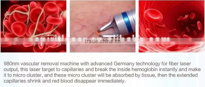 Spiritlaser fda approved diode laser equipment vascular remover 980nm Diode Laser Vascular Removal Laser Treatment