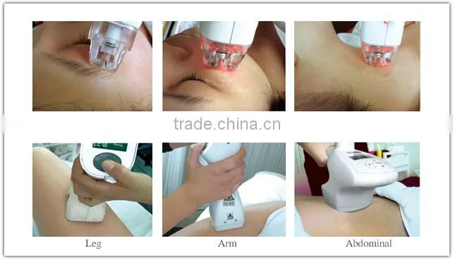 Professional cellulite massage machines/roller facial vacuum suction machine/cellulite roller massage