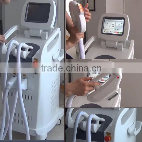 Super hair removal best seller painless hair removal elight shr