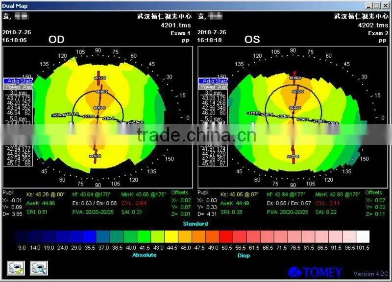 High-technology Mild MCT ,fpr myopia and amblyopia China