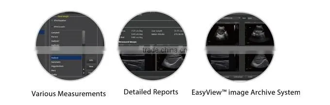 ECO2 high image quality good price black and white portable ultrasound Chison