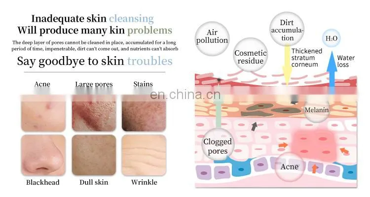 11 in 1 Hydra dermabrasion aqua peel Facial Deep Cleaning microdermabrasion instrument Water Oxygen Face lifting beauty Device