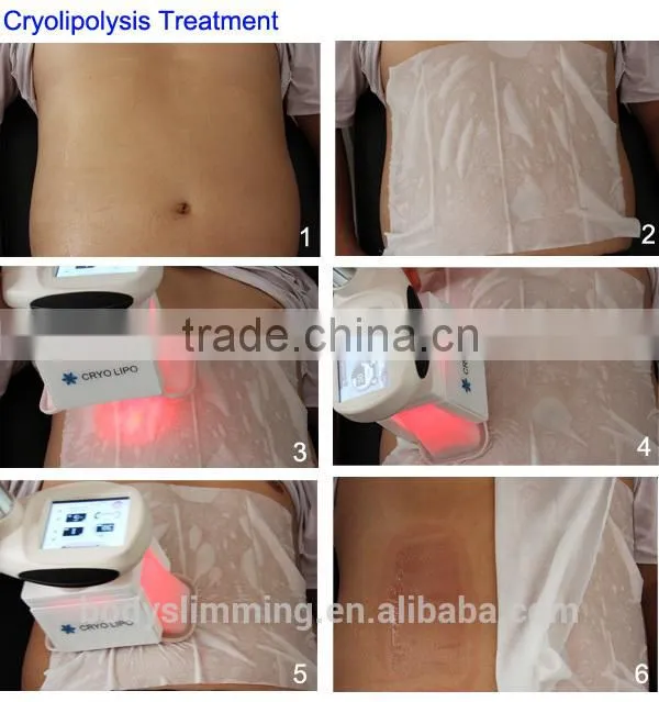 Cooling slimming slim freezer weight loss slim freeze belt