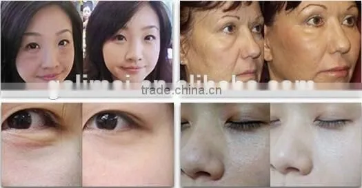 Top rated good pump 4 in 1 oxygen and water jet peel facial skin care machine for facial cleaning and rejuvenation