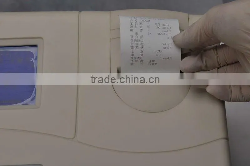 4 Test Items Urinalysis Analyzer