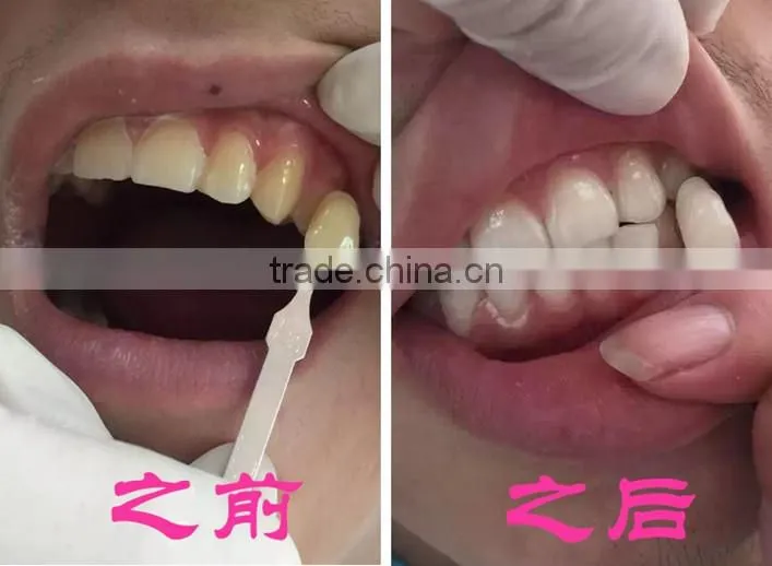 Classic Floor Stand LED Technology Gel Teeth Whitening Machine