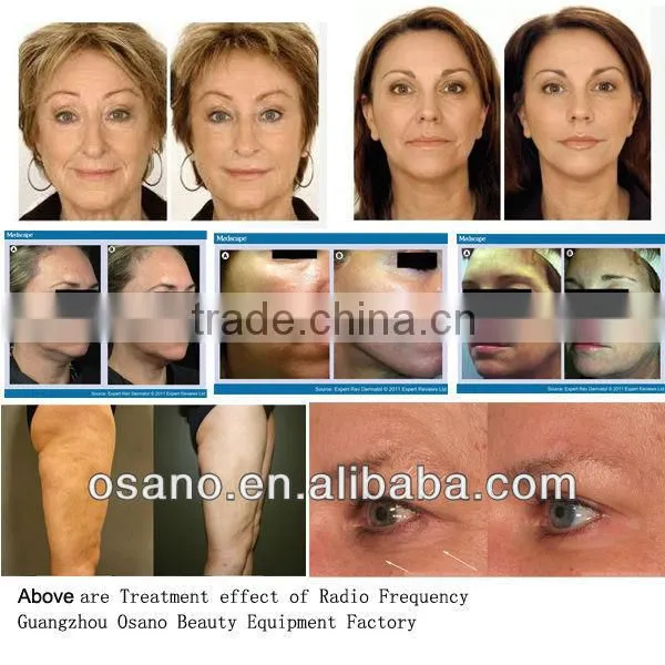 Salon Beauty Equipment Cavitation RF cavitation & radio frequency