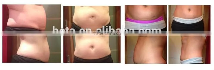 Heta H-1001 Factory price body slimming beauty rf ultrasonic cavitation portable equipment