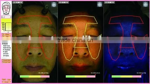 WT-03-S Super Trispectrum Magic mirror skin scanner analyzer
