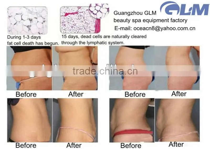 4 in 1 fat freezing rf 40K cavitation weight loss machine with CE