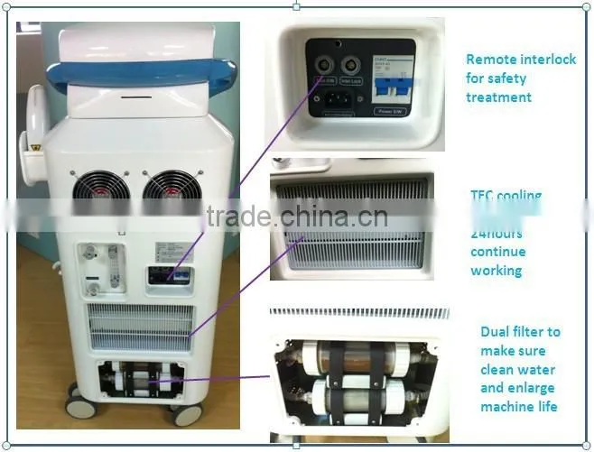 2015 Diode Laser Hair Removal machine for Blond hair removal