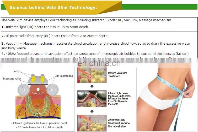 5 handles vertical body shaping vacuum roller cellulite machine velaslim weight loss machine