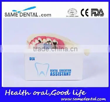 Hemi mandible anatomical model Dental Eduction Assitant No. DEA-18