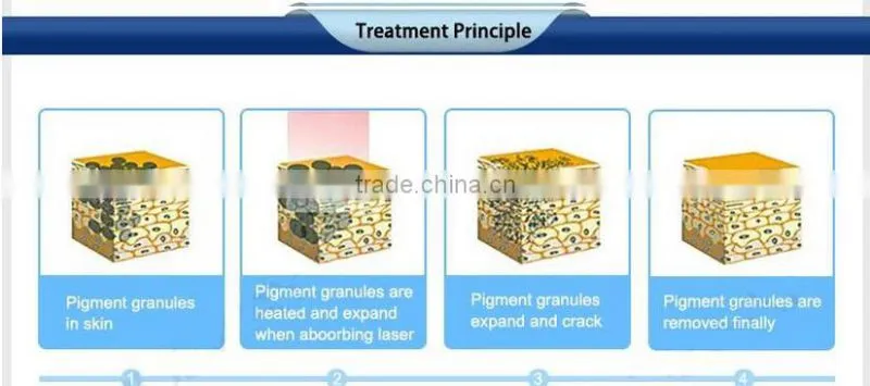 Q-switch ND-1 YAG laser removal all tattoos with manual and video with low price