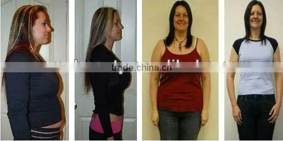 Low cost !!ultrasonic liposuction cavitation rf slimming machine with CE approval