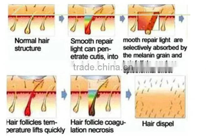 Good Price!! Beauty Device remov tattoo Laser Machine