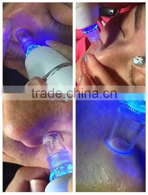 2016 Wholesale price vacuum blackhead remover for home use