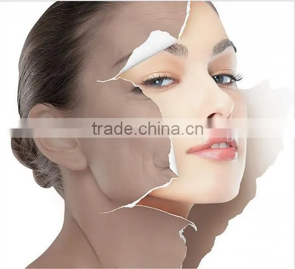 IPL ICE SHR SSR Hair Removal Skin Rejuvenation Pigmentation&Vascular&Acne&Spot Removal Beauty Salon Equipment&Machine