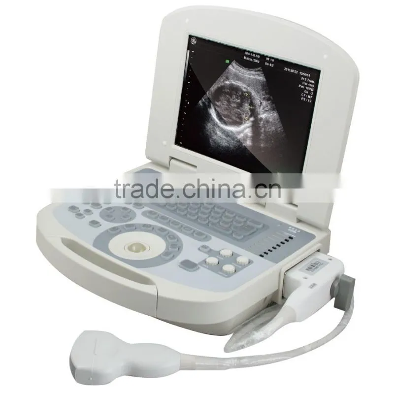 10 inch portable ultrasound scanner USG machine with 3.5Mhz convex probe for OB/GYN urology etc