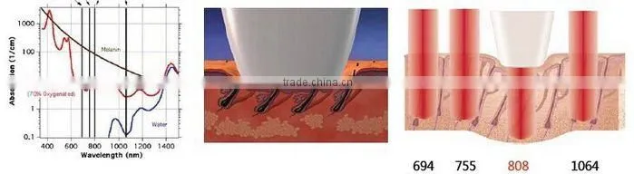 Factory price 808nm diode laser epilation desktop machine with hair removal laser handpiece
