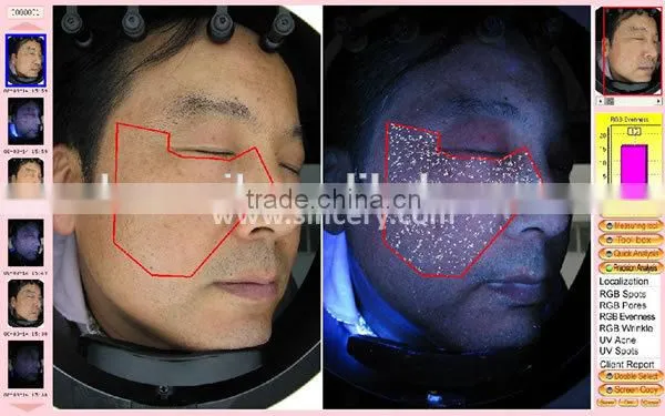 2014 Latest Magic Mirror System 3d skin analyzer