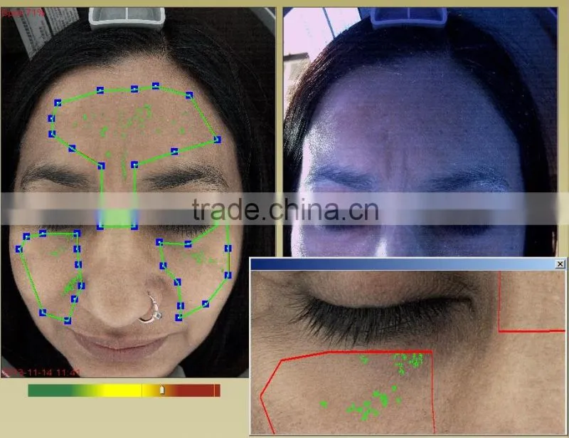 2016 Magic mirror skin analysis device skin analyzer high pixel