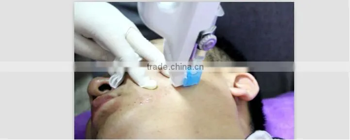 sodium hyaluronate /hyaluronan microneedling meso gun/pen