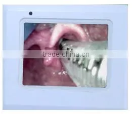 Uheal anesthesia intubationscope instrument airway management endoscope