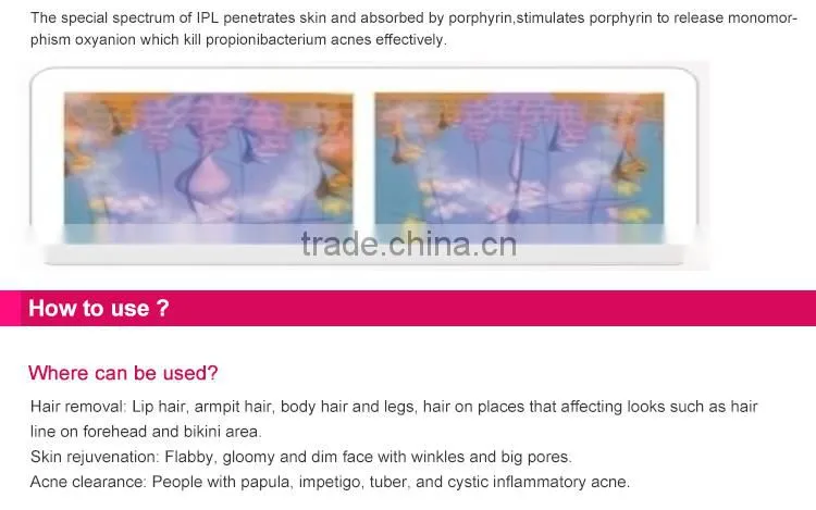 Best selling products portable IPL beauty machine for home use/ipl hair removal