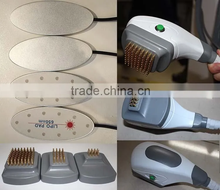 2015 best selling machine smart lipo machine laser cutting machine