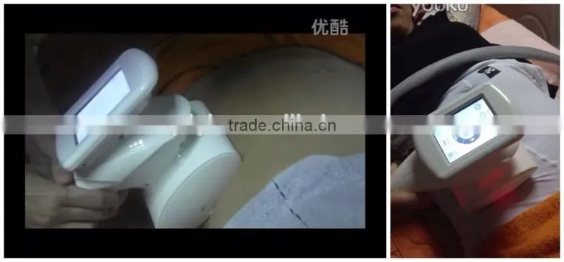 Laser Cavitation RF Vacuum Slimming Machine/B-015A