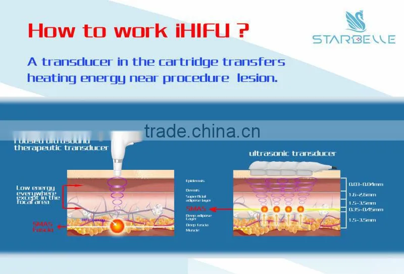 hifu lifting rf beauty skin rejuvenation machine-iHifu