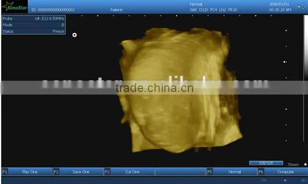 Sonostar hospital veterinary equipment B model ultrasound machine for sale V9