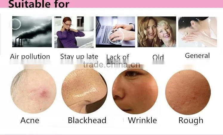 Professional home washing mini type ultrasonic skin scrubber for facial cleaning