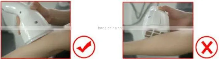 Electroporation and Radio Frequency Beauty Equipment