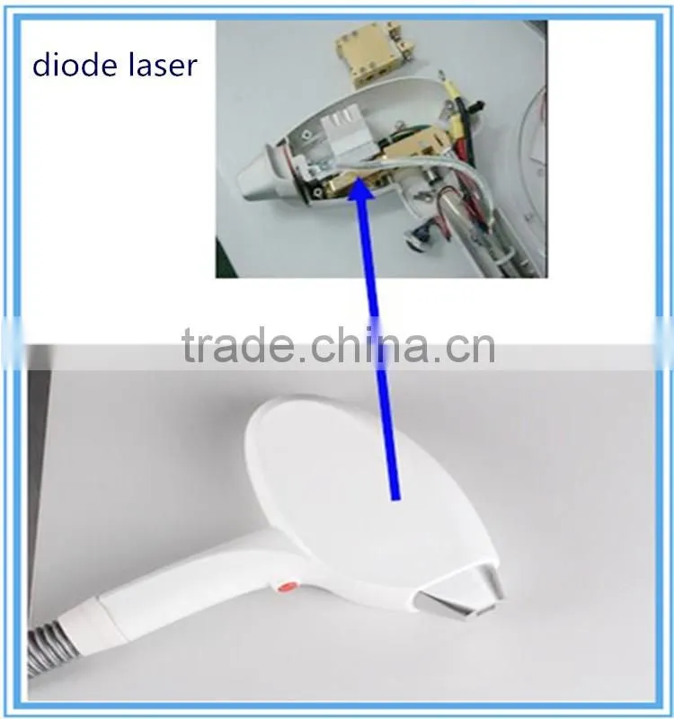 2016 professional diode laser 808nm laser hair removal machine for sale