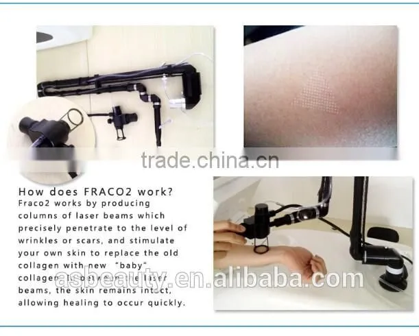 Portable 10600nm CO2 fractional laser equipment for scar removal/handheld co2 laser